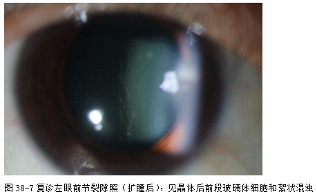 ZY016_203_4.gif